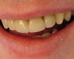 Slider image (7) PruDent-Hungary